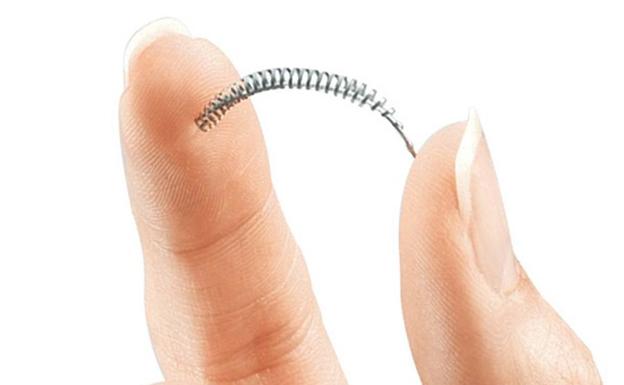 El anticonceptivo 'Essure'./