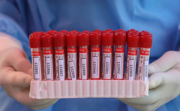 ¿Qué municipios tienen nuevos casos de covid este miércoles? 