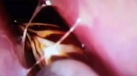Si Pisas Una Cucaracha Se Quedan Los Huevos